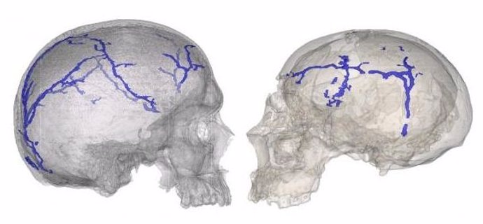 Estudio para analizar el sistema vascular interno del cráneo