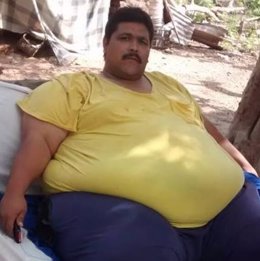 Andrés Moreno, considerado el hombre más gordo del mundo