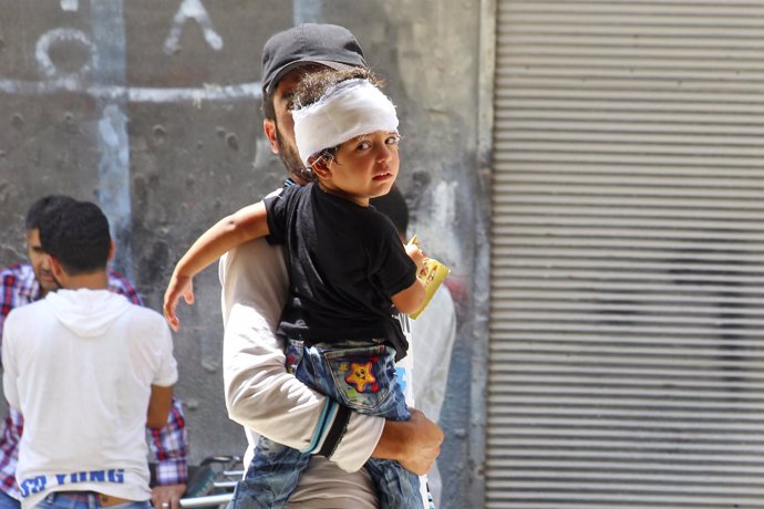 Niño herido en Siria
