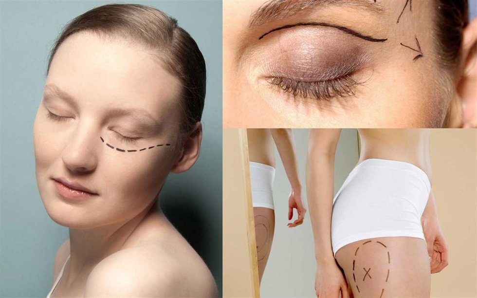 Black Friday llega al mundo de la estética