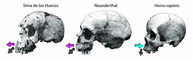 Diferencias en la formación del cráneo