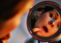 Desmontando los mitos del acné