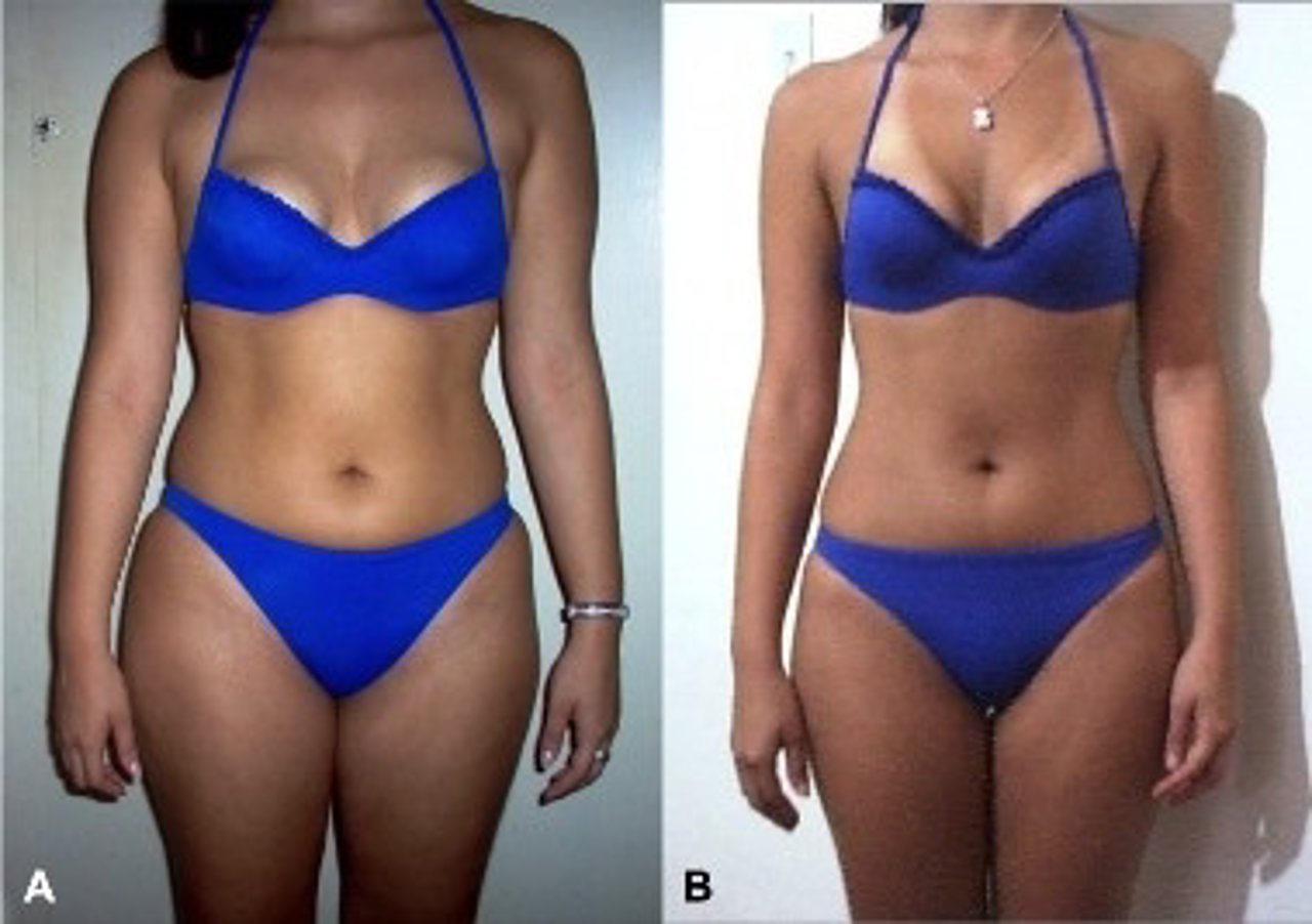 Imágenes de una persona a dieta cedidas por los investigadores