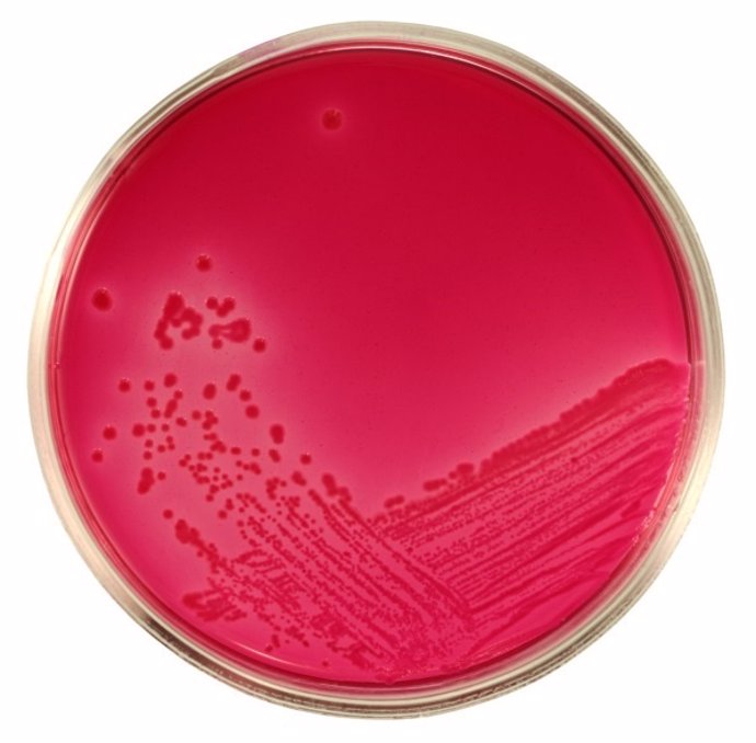 Escherichia coli, bacteria