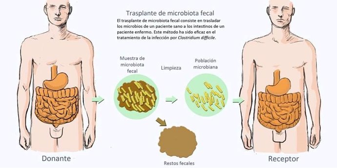 INFOGRAFÍA TRASPLANTE DE MICROBIOTA FECAL