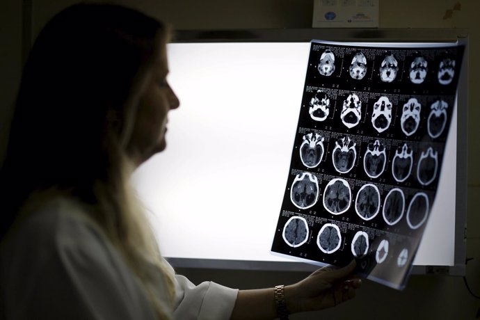 Child Neurologist Vanessa Van Der Linden observes the X-ray of a baby's skull wi
