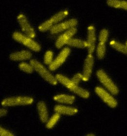 Imagen de una colonia de bacterias