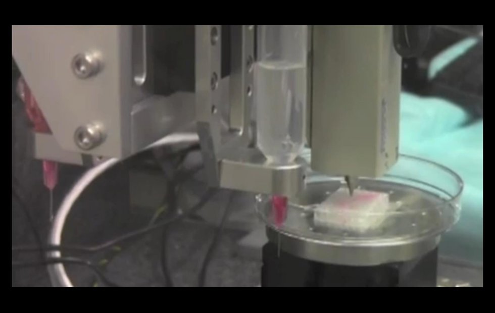 Foto: WAKE FOREST INSTITUTE