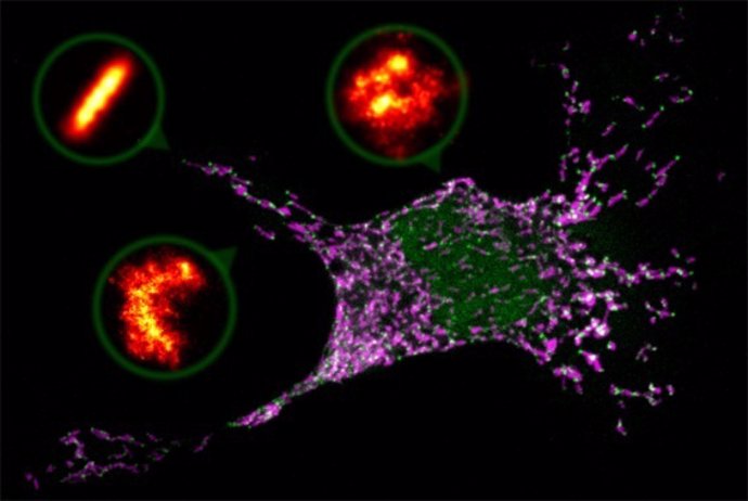 Imagen de apoptosis celular