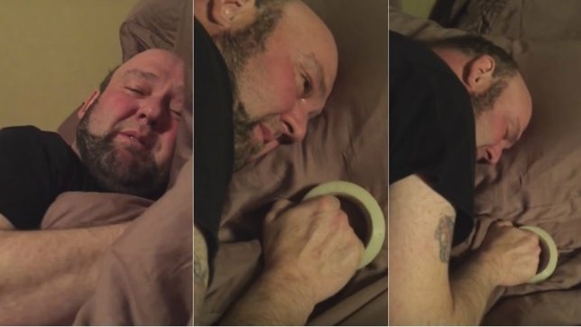 Hombre cree que se le va a caer la cabeza tras una fuerte sedación