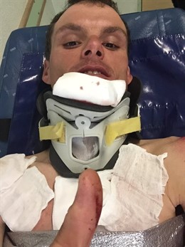 Luis León Sánchez tras su caída en el Algarve