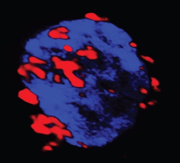 Célula autoreactiva (azul) que capta los nanofármacos (rojo)