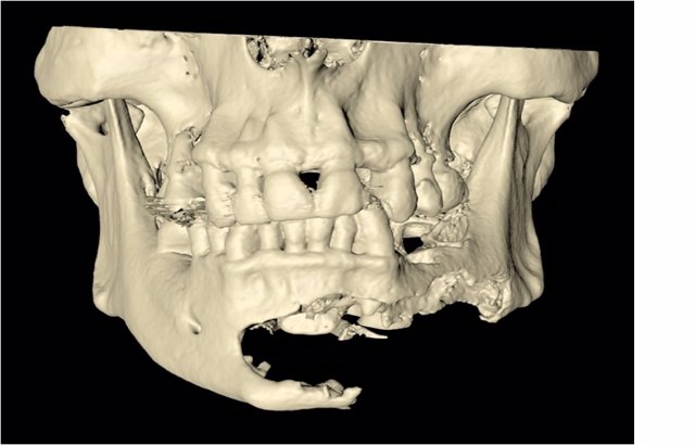 Cirugía Oral y Maxilofacial 