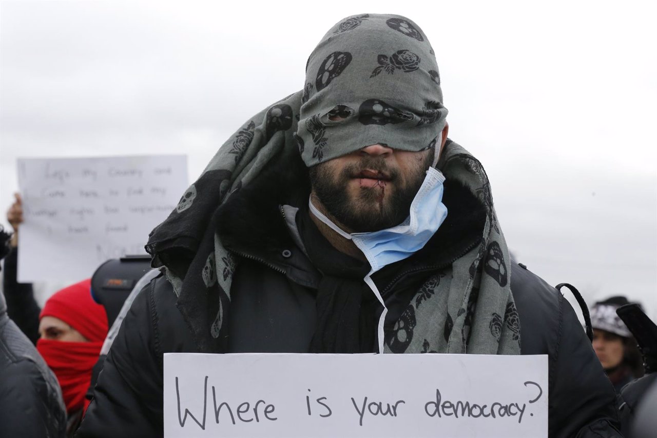 Un inmigrante se cose la boca en el campamento de Calais (Francia)