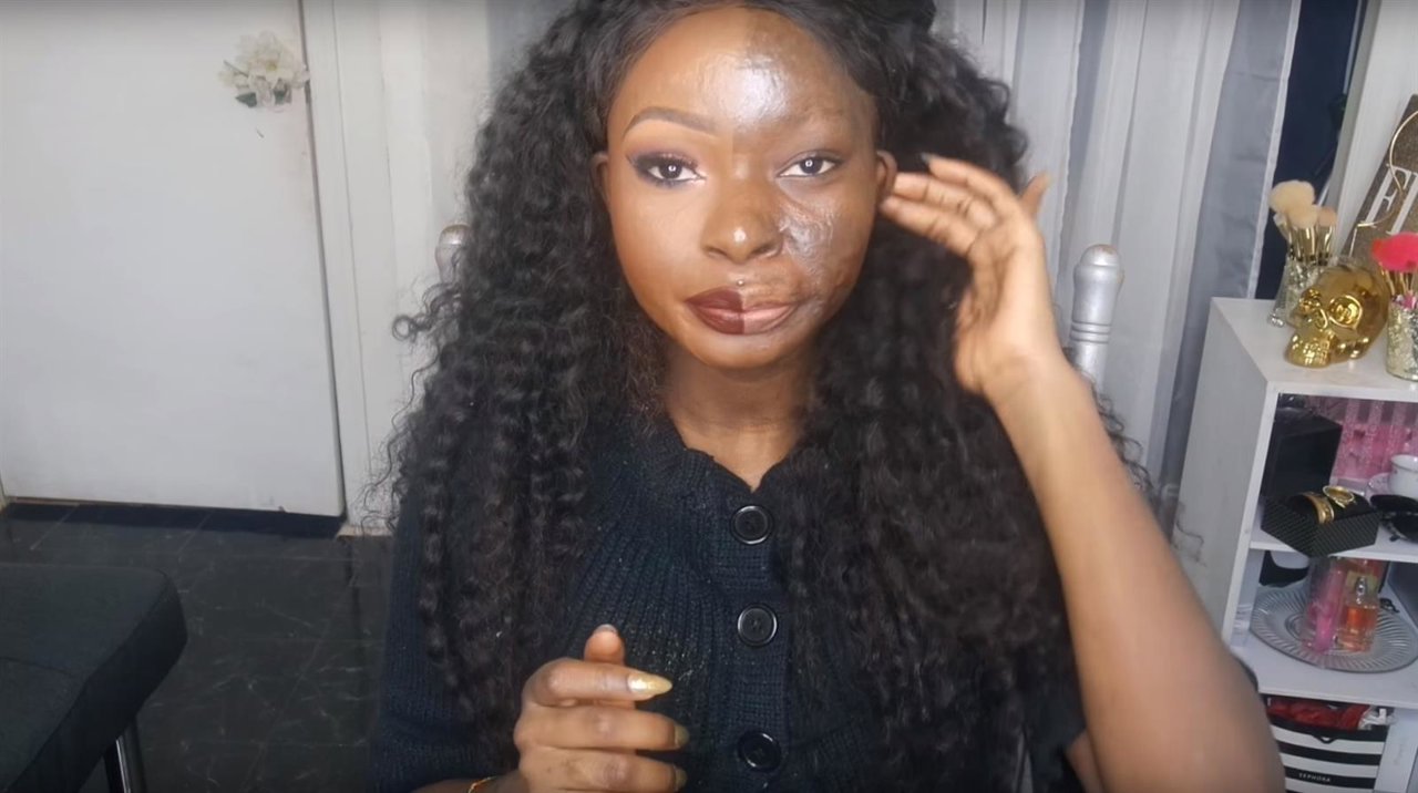 Chica con quemaduras en el rostro muestra su belleza real