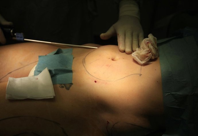 Operación de liposucción