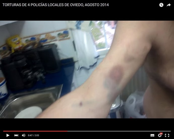 Vídeo en el que el denunciante muestra los daños de la supuesta tortura. 
