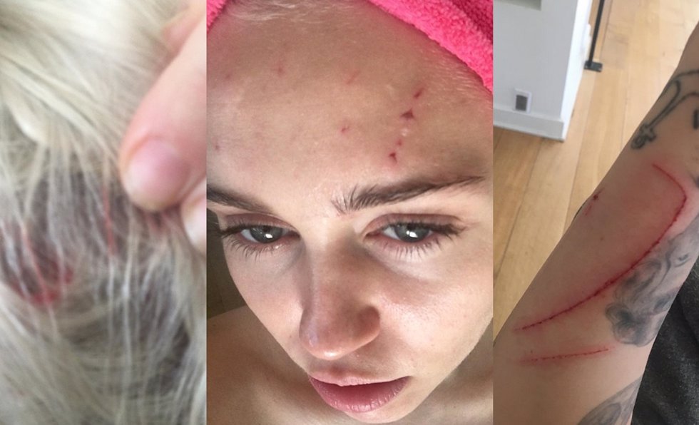 Miley Cyrus brutalmente atacada... ¡Por un gato!