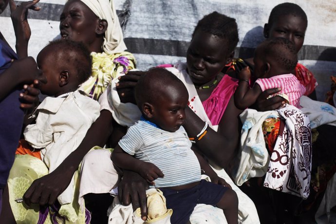 Niños desnutridos en Sudán del Sur