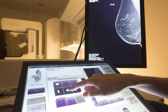 Mesa del Castillo incorpora la Imagen Sintetizada a la mamografía 3D
