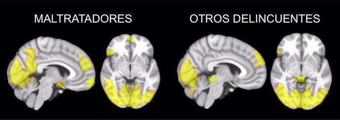 Estudio sobre el cerebro de maltratadores y el de otros delincuentes