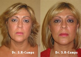 Clínica Rodríguez-Camps