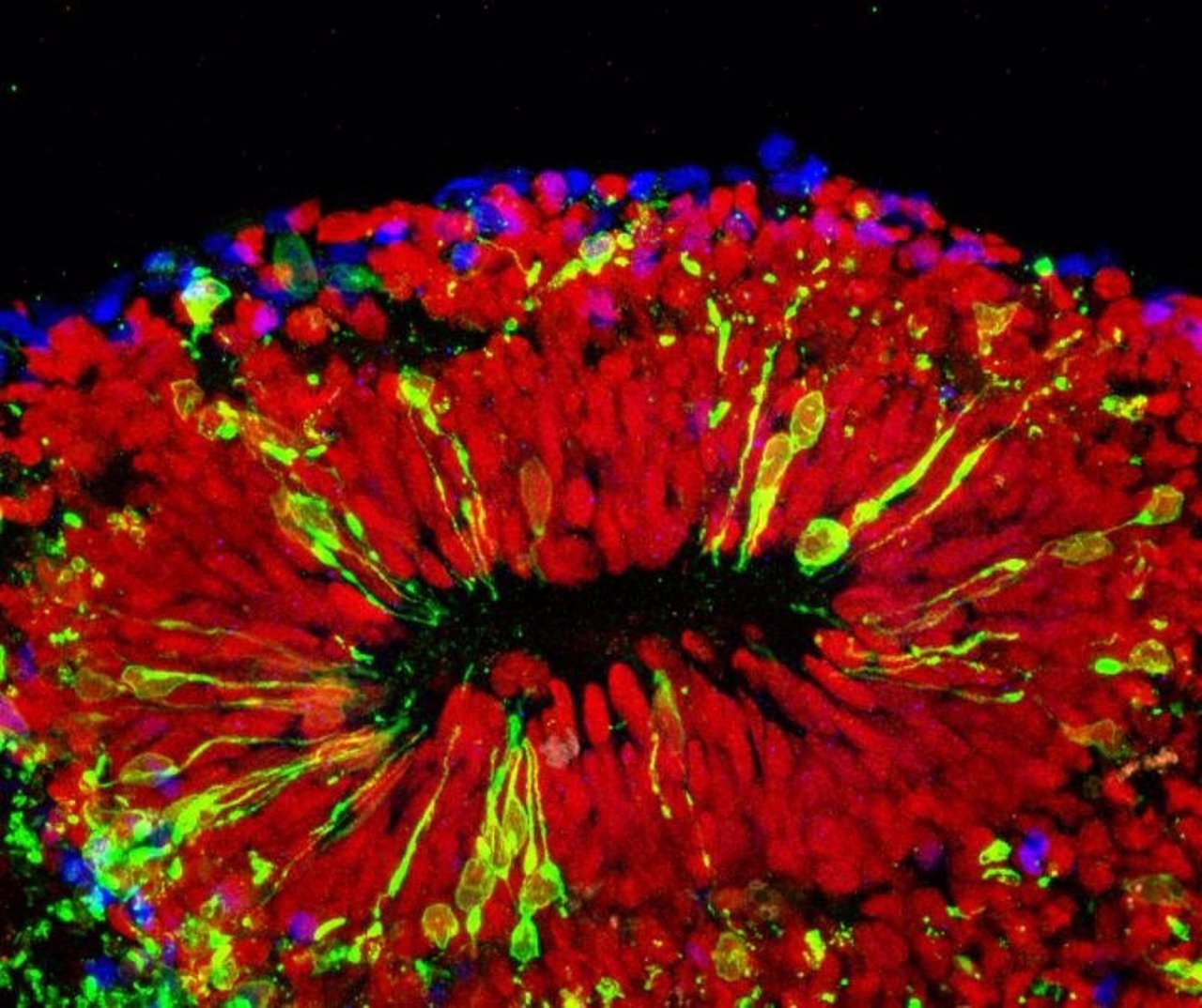 Minicerebros evidencian el daño del virus en el cerebro del feto
