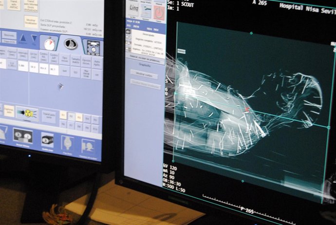 TAC a la talla de San José.