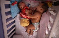 Científicos brasileños estudian casos de mellizos relacionados con el Zika