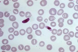 Parásitos de la malaria entre glóbulos rojos normales