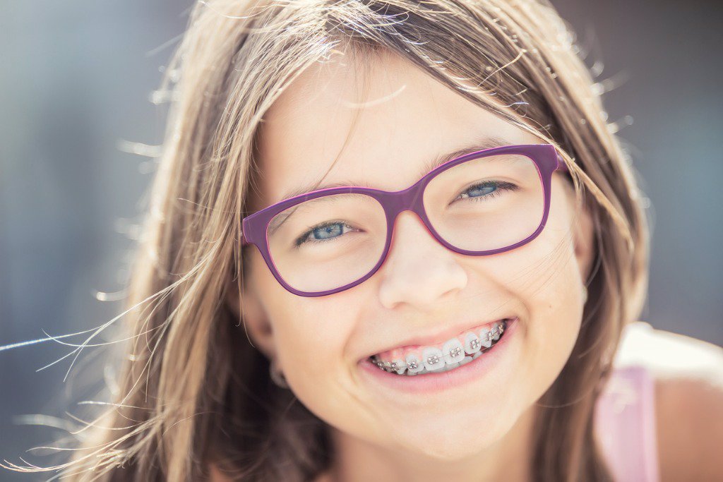 Ortodoncia Infantil Cuando Y Como Corregir La Alineacion De Los Dientes