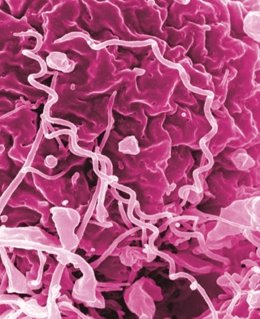 Treponema pallidum, bacteria de la sífilis