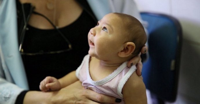 Niño con microcefalia por zika