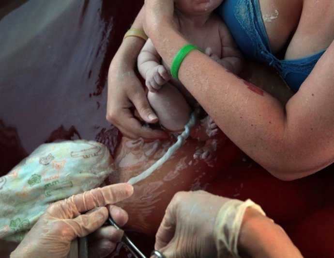 Cordón umbilical