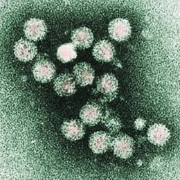 Virus de la hepatitis C