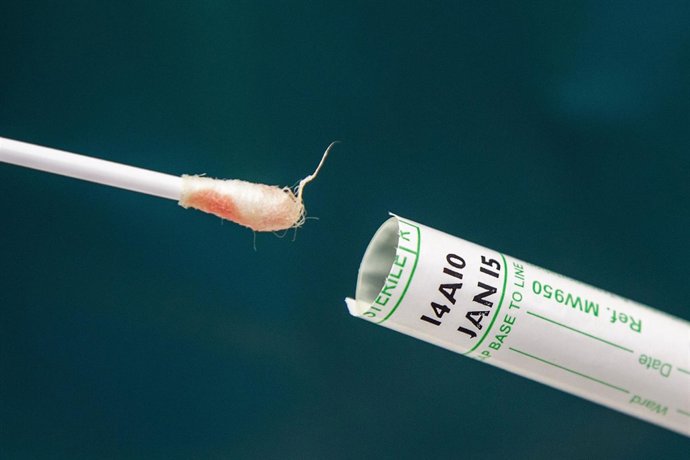 Gripe aviar, influenza aviaria