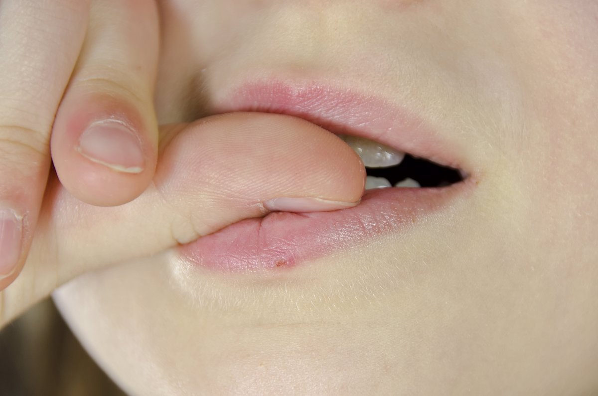 Comerse las uñas un problema para nuestros dientes  Clínica Dental Centro