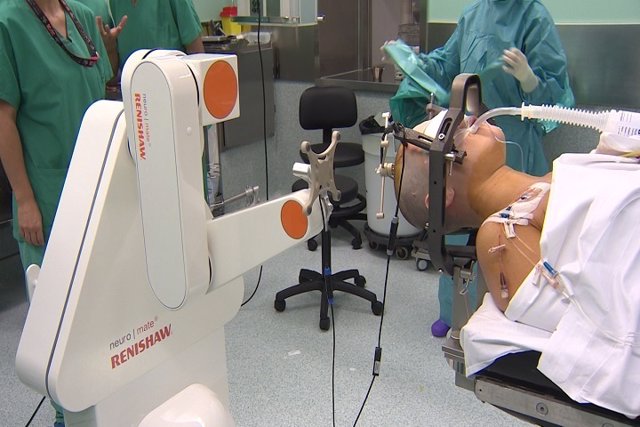 Operación para tratar la epilepsia realizada en Teknon con un robot