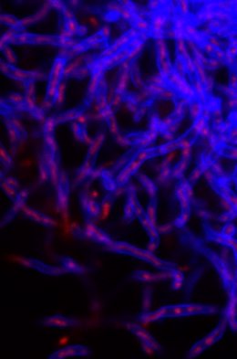 Hifas vistas a través de un microscopio confocal