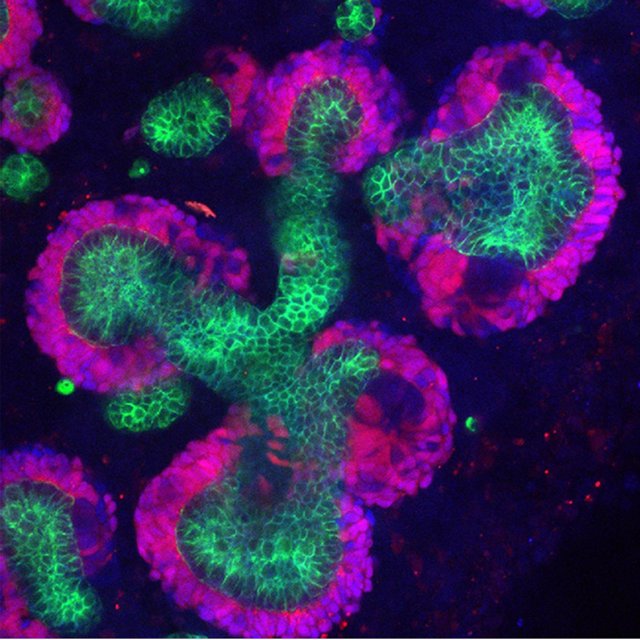 Células progenitoras de riñón humanas cultivadas en 3D en el laboratorio
