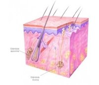 'Hidradenitis supurativa', la enfermedad "rara" que padecen más de 30.000 uruguayos