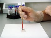 Foto: Nuevos biomarcadores en sangre hacen más factible un futuro test del Alzheimer