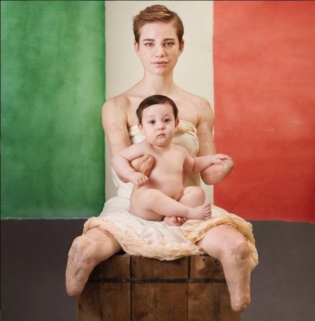 Campaña promovida por la fotógrafa Anne Geddes para concienciar sobre meningitis