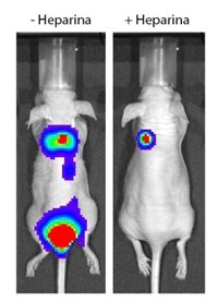 Una molécula que inhibe la coagulación de la sangre también sirve para combatir el cáncer
