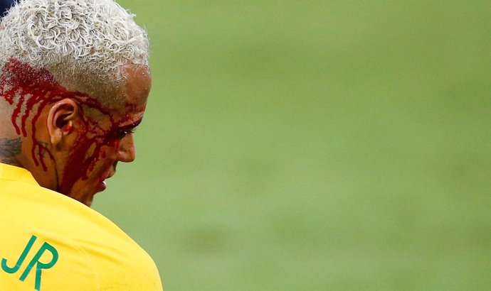 Neymar sangra tras un codazo en el Brasil - Bolivia