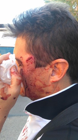 Policía Local agredido