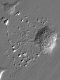 Investigadores españoles convierten células de la piel humana en plaquetas