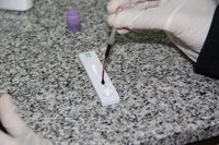 Casi el 50% de los pacientes con VIH no se ha hecho el test para detectarlo