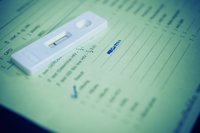 ¿Cómo es la prueba del VIH?