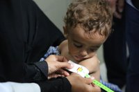 Un millón y medio de niños en Yemen sufren desnutrición aguda a causa de la guerra